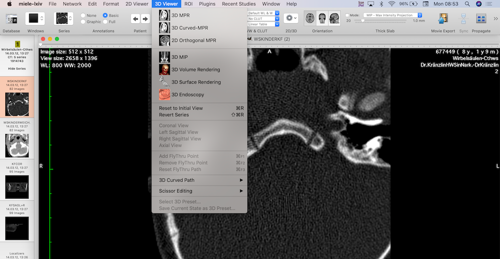 pacs viewer for mac